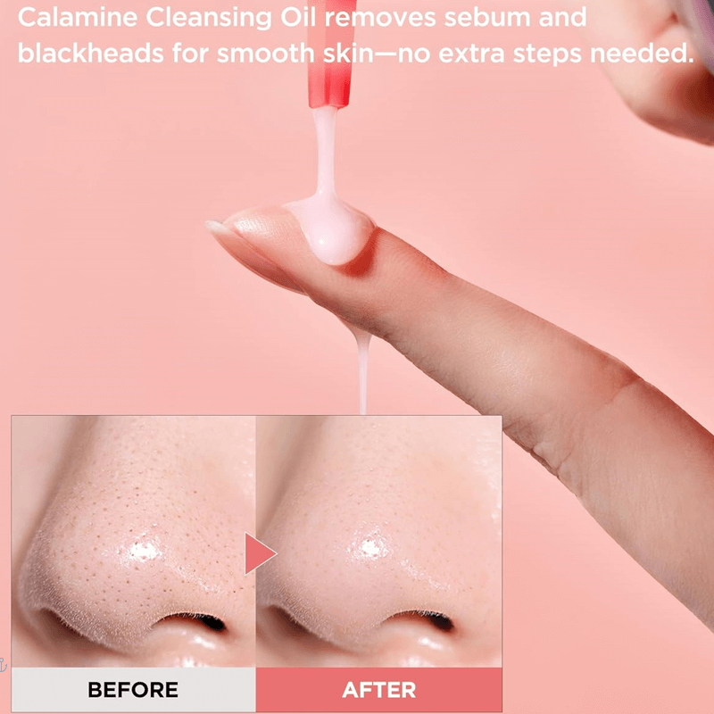 توكوبو زيت تنظيف كالامين للتحكم بالمسام